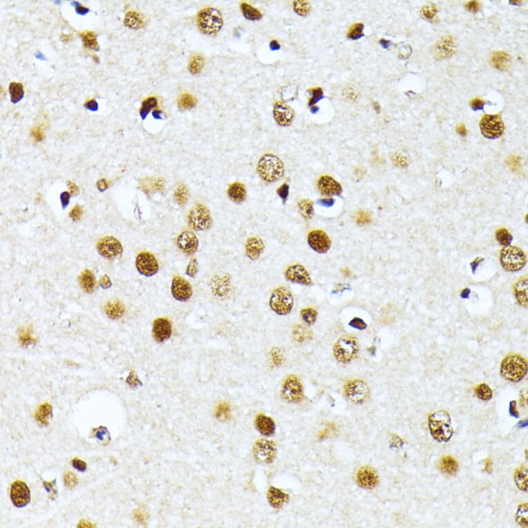 Immunohistochemistry - Anti-PRMT1 Antibody (A12991) - Antibodies.com