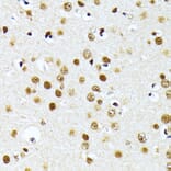 Immunohistochemistry - Anti-PRMT1 Antibody (A12991) - Antibodies.com