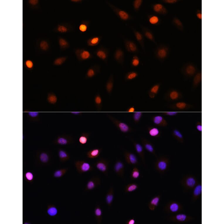 Immunofluorescence - Anti-PRMT1 Antibody (A12991) - Antibodies.com