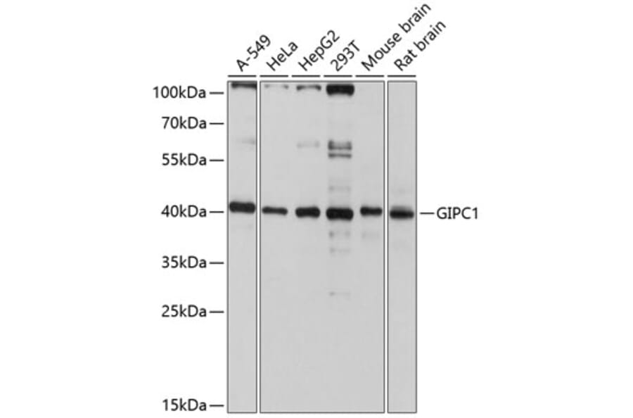 Western Blot - Anti-GIPC1 Antibody (A12992) - Antibodies.com
