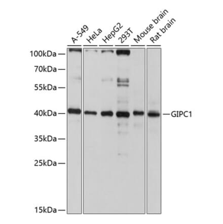 Western Blot - Anti-GIPC1 Antibody (A12992) - Antibodies.com