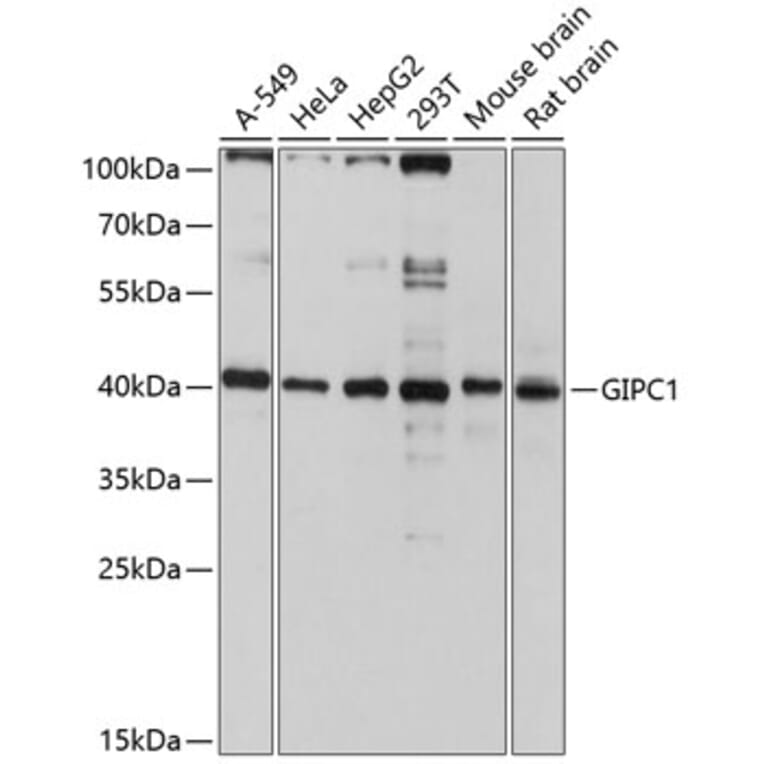 Western Blot - Anti-GIPC1 Antibody (A12992) - Antibodies.com