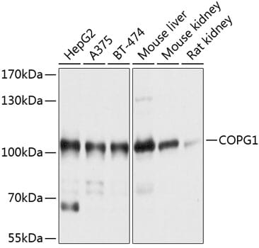 Western blot analysis of extracts of various cell lines, using Anti-COPG1 Antibody (A10551) at 1:1,000 dilution.
Secondary antibody: Goat Anti-Rabbit IgG (H+L) (HRP) (AS014) at 1:10,000 dilution.
Lysates / proteins: 25µg per lane.
Blocking buffer: 3% non-fat dry milk in TBST.
Detection: ECL Basic Kit (RM00020).
Exposure time: 1s.