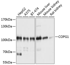 Western Blot - Anti-COPG1 Antibody (A12993) - Antibodies.com