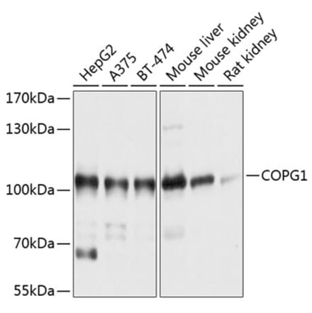 Western Blot - Anti-COPG1 Antibody (A12993) - Antibodies.com