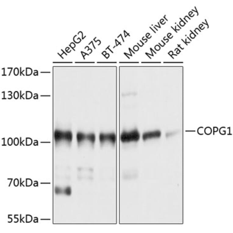 Western Blot - Anti-COPG1 Antibody (A12993) - Antibodies.com