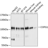 Western Blot - Anti-COPG1 Antibody (A12993) - Antibodies.com