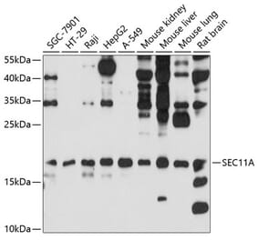 Western Blot - Anti-SEC11A Antibody (A12994) - Antibodies.com
