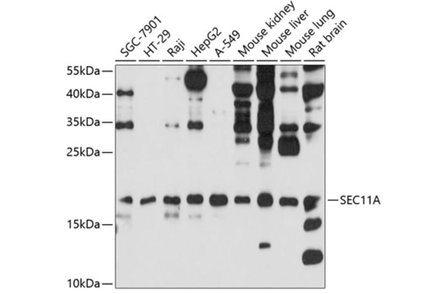 Western Blot - Anti-SEC11A Antibody (A12994) - Antibodies.com
