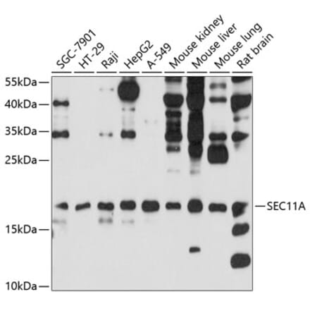 Western Blot - Anti-SEC11A Antibody (A12994) - Antibodies.com