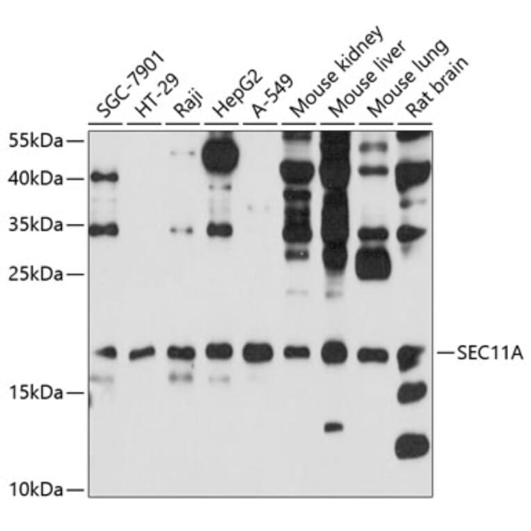 Western Blot - Anti-SEC11A Antibody (A12994) - Antibodies.com