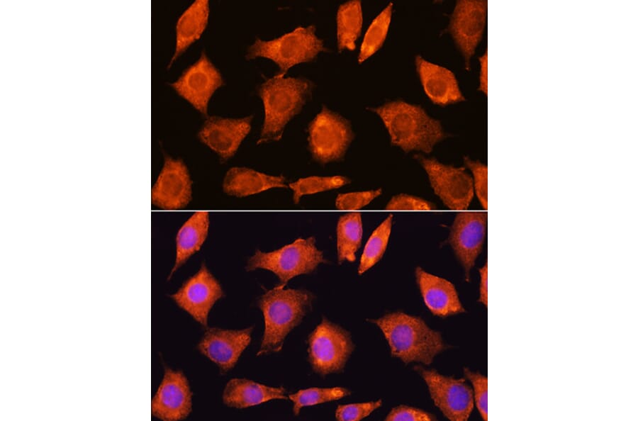 Immunofluorescence - Anti-SEC11A Antibody (A12994) - Antibodies.com
