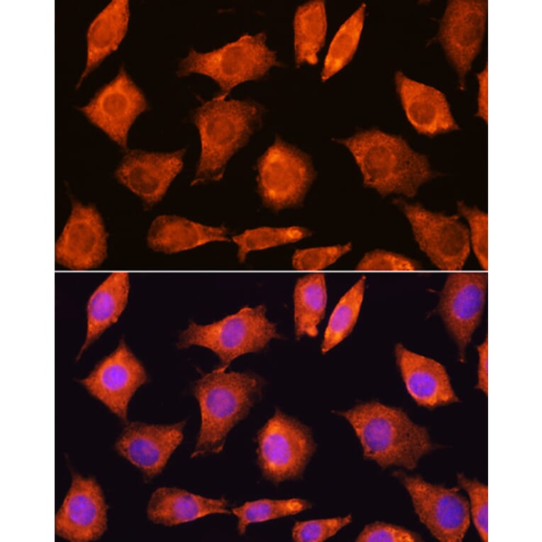 Immunofluorescence - Anti-SEC11A Antibody (A12994) - Antibodies.com