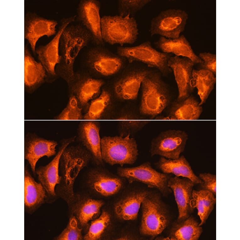Immunofluorescence - Anti-SEC11A Antibody (A12994) - Antibodies.com