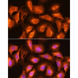 Immunofluorescence - Anti-SEC11A Antibody (A12994) - Antibodies.com