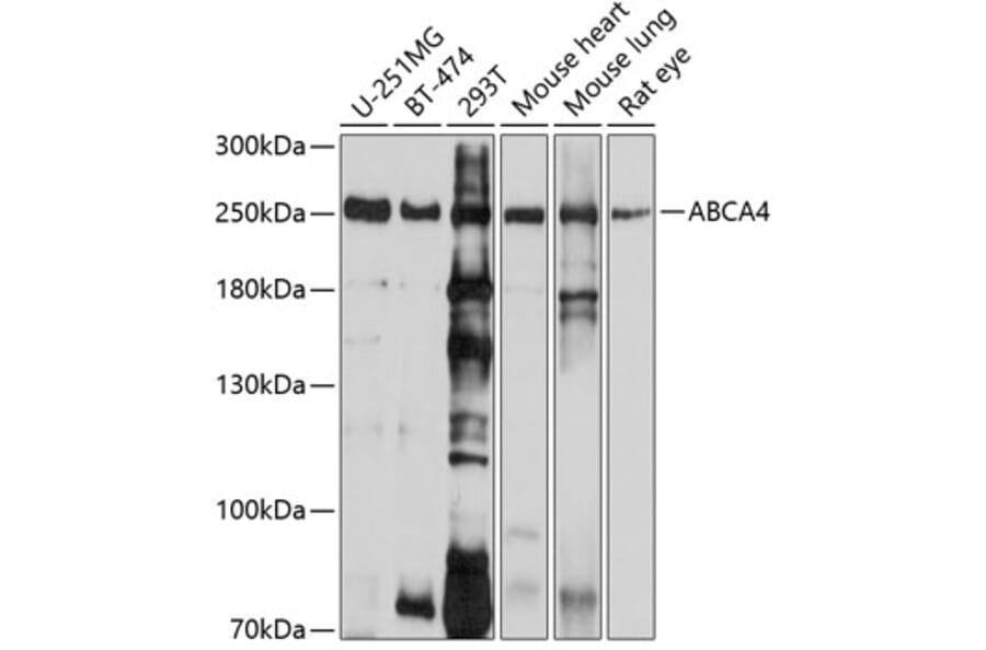Western Blot - Anti-ABCA4 Antibody (A10556) - Antibodies.com