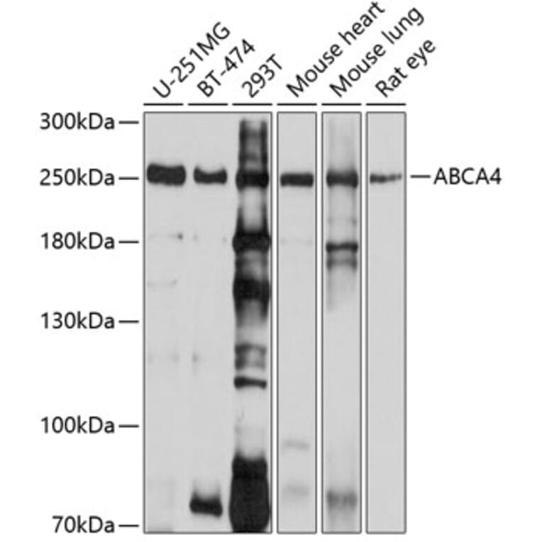 Western Blot - Anti-ABCA4 Antibody (A10556) - Antibodies.com