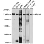 Western Blot - Anti-ABCA4 Antibody (A10556) - Antibodies.com