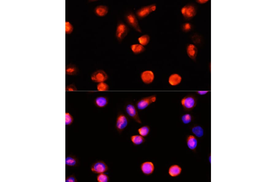 Immunofluorescence - Anti-ABCA4 Antibody (A10556) - Antibodies.com