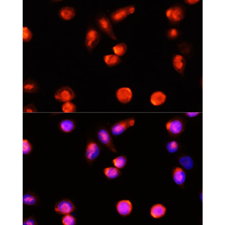 Immunofluorescence - Anti-ABCA4 Antibody (A10556) - Antibodies.com