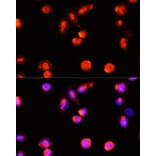 Immunofluorescence - Anti-ABCA4 Antibody (A10556) - Antibodies.com