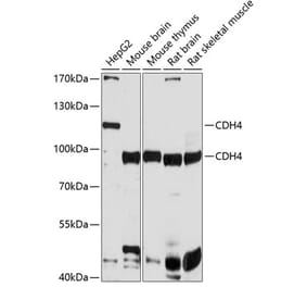 Western Blot - Anti-R Cadherin Antibody (A12997) - Antibodies.com