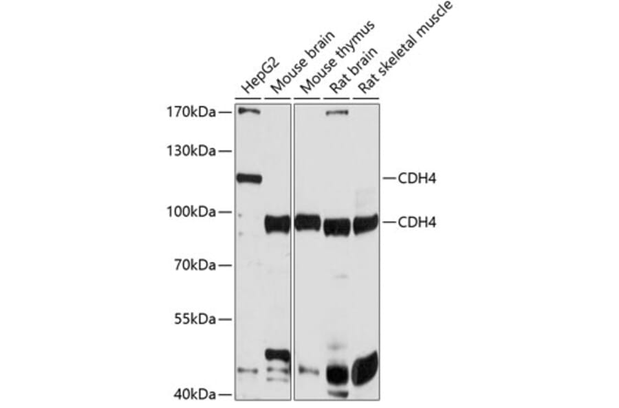 Western Blot - Anti-R Cadherin Antibody (A12997) - Antibodies.com
