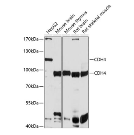 Western Blot - Anti-R Cadherin Antibody (A12997) - Antibodies.com