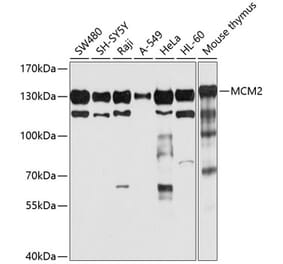 Western Blot - Anti-MCM2 Antibody (A12998) - Antibodies.com