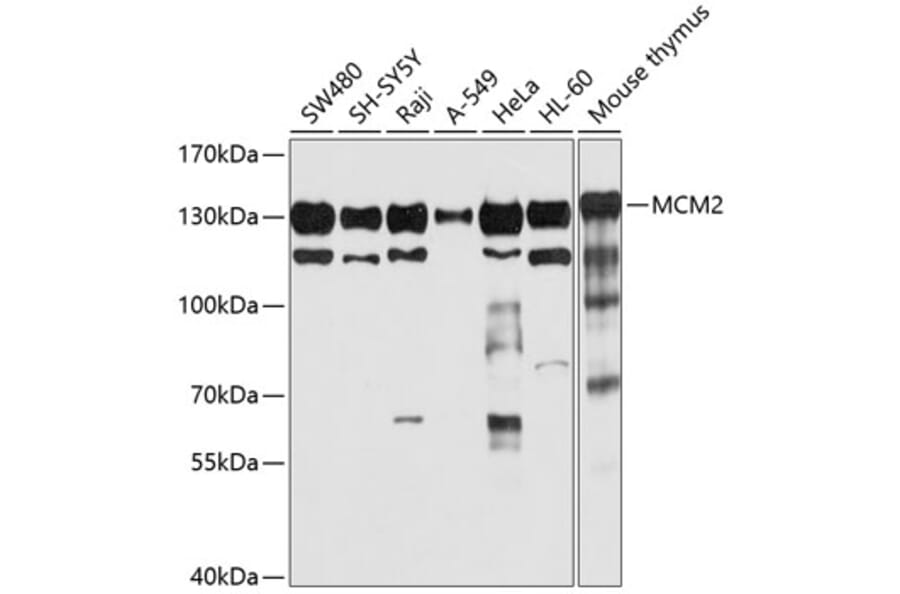 Western Blot - Anti-MCM2 Antibody (A12998) - Antibodies.com