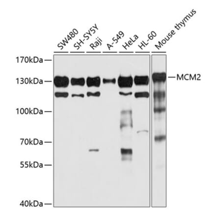 Western Blot - Anti-MCM2 Antibody (A12998) - Antibodies.com