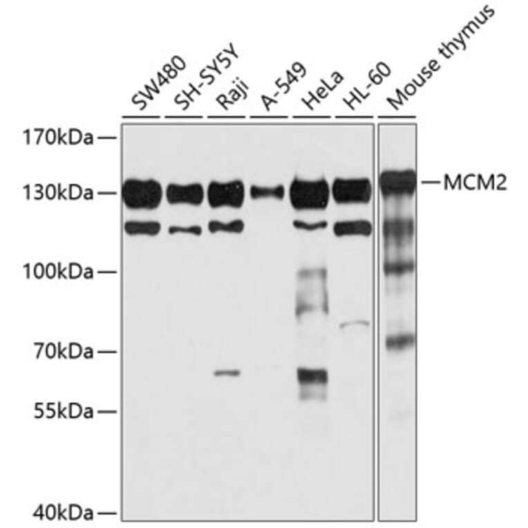 Western Blot - Anti-MCM2 Antibody (A12998) - Antibodies.com