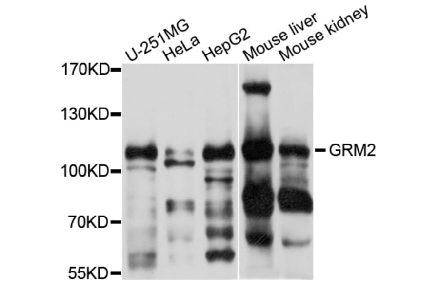 Western Blot - Anti-GRM2 Antibody (A10561) - Antibodies.com