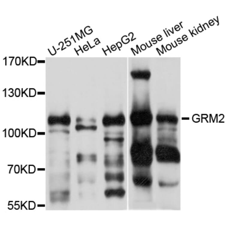 Western Blot - Anti-GRM2 Antibody (A10561) - Antibodies.com