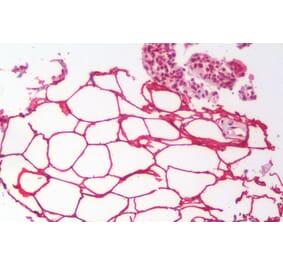 Immunohistochemistry - Anti-KIAA1881 Antibody (A121143) - Antibodies.com
