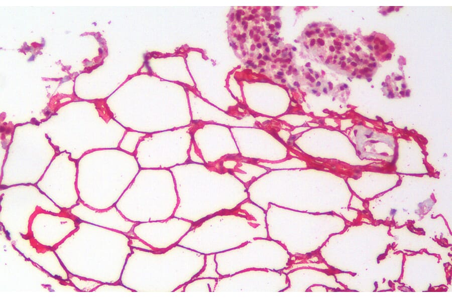 Immunohistochemistry - Anti-KIAA1881 Antibody (A121143) - Antibodies.com