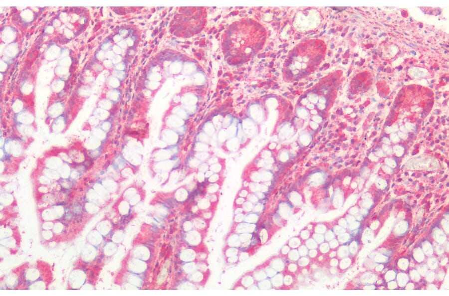 Immunohistochemistry - Anti-Cathepsin B Antibody (A121144) - Antibodies.com