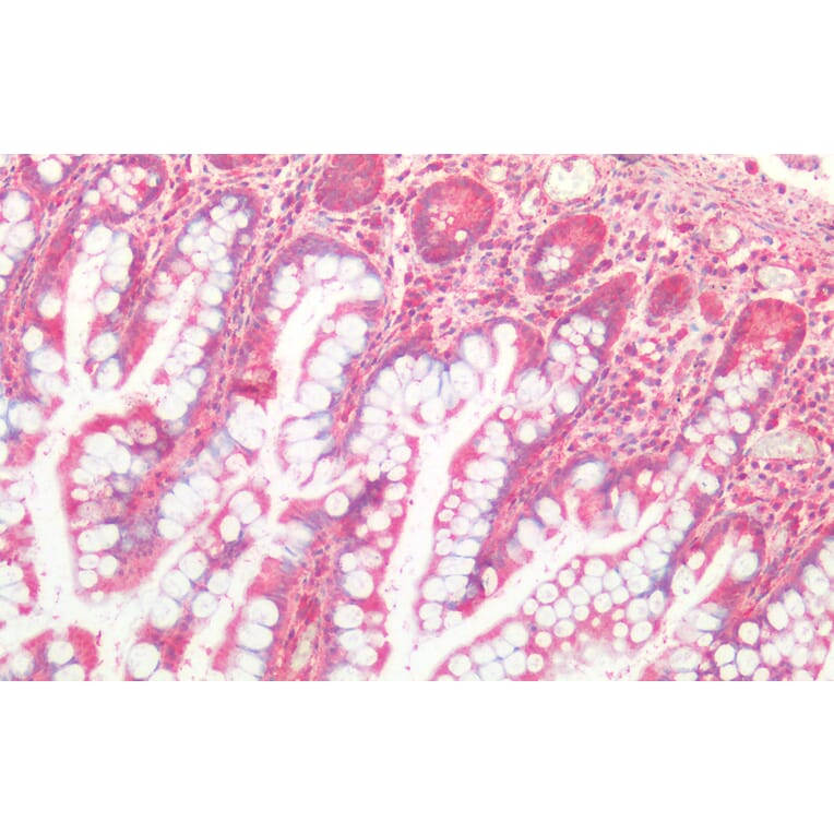 Immunohistochemistry - Anti-Cathepsin B Antibody (A121144) - Antibodies.com