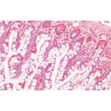 Immunohistochemistry - Anti-Cathepsin B Antibody (A121144) - Antibodies.com