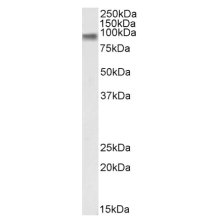 Western Blot - Anti-beta Catenin Antibody (A121145) - Antibodies.com