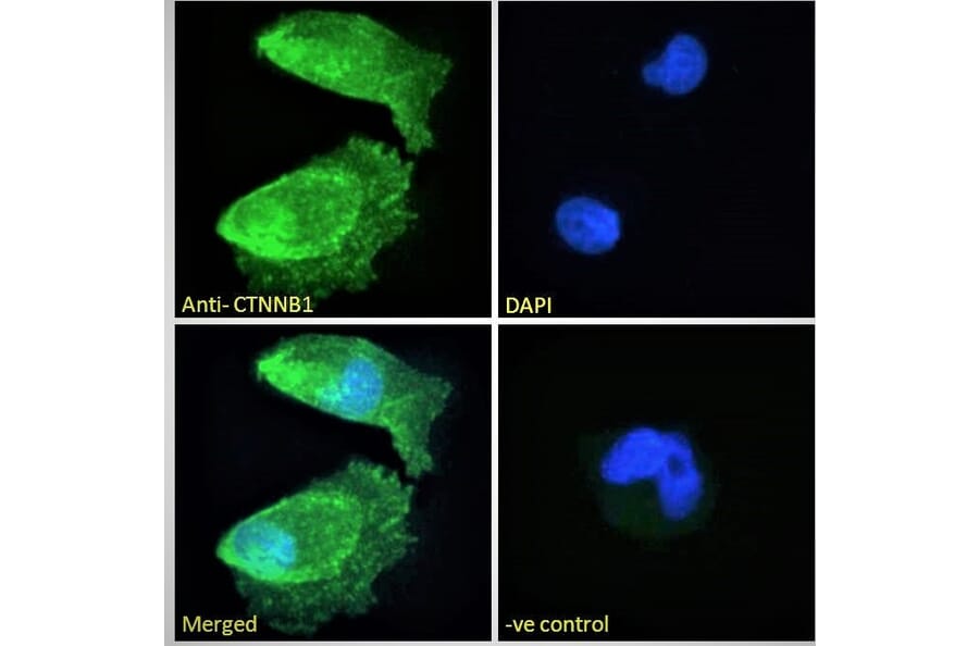 Immunofluorescence - Anti-beta Catenin Antibody (A121145) - Antibodies.com