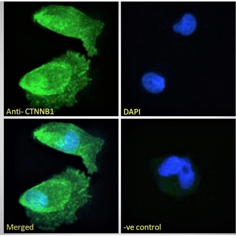 Immunofluorescence - Anti-beta Catenin Antibody (A121145) - Antibodies.com