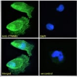 Immunofluorescence - Anti-beta Catenin Antibody (A121145) - Antibodies.com