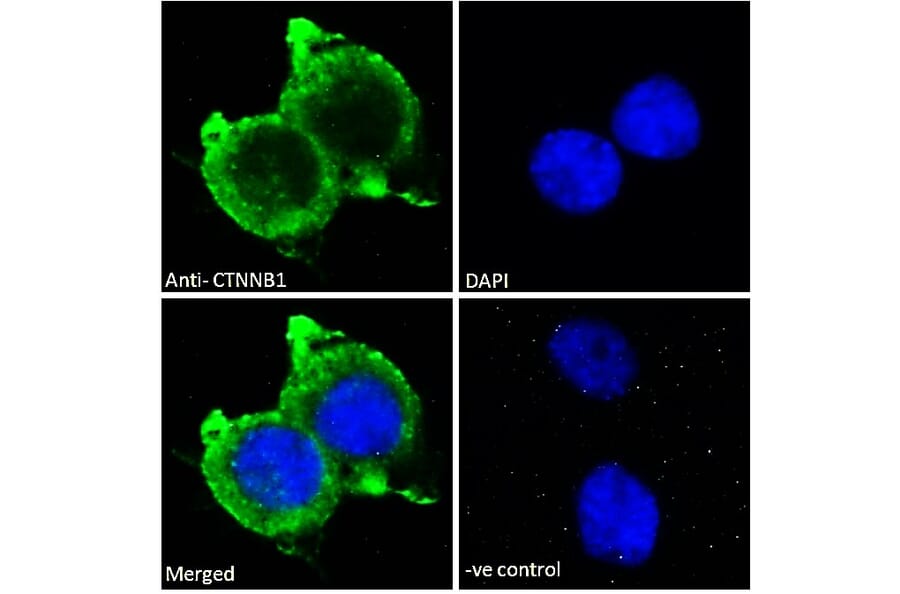 Immunofluorescence - Anti-beta Catenin Antibody (A121145) - Antibodies.com