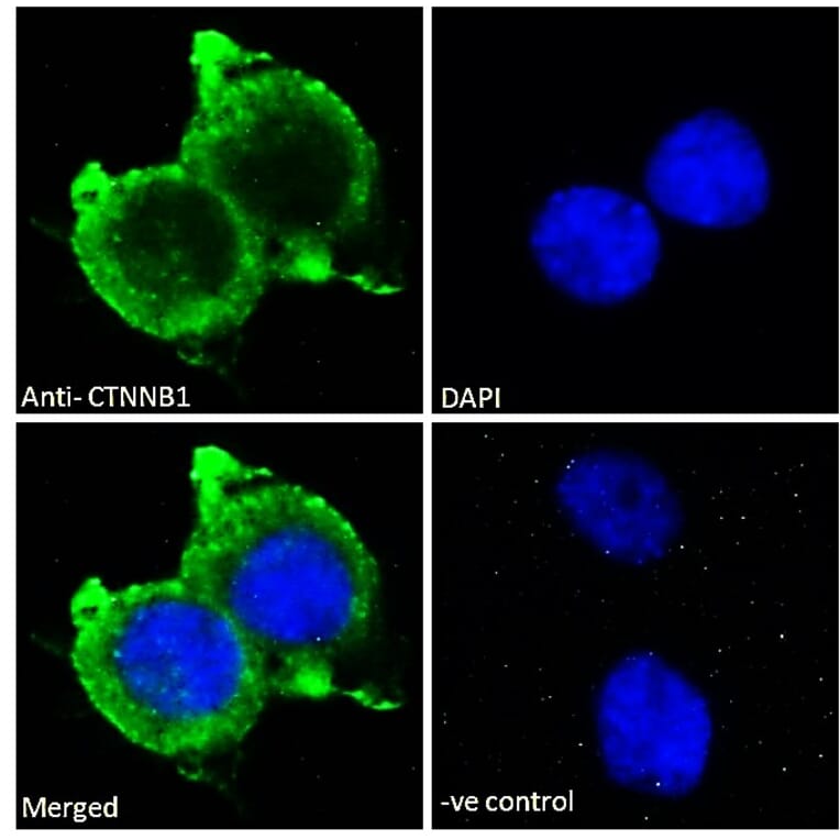 Immunofluorescence - Anti-beta Catenin Antibody (A121145) - Antibodies.com