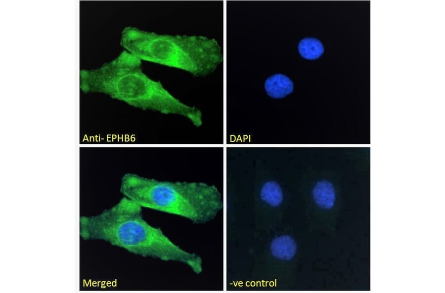 Immunofluorescence - Anti-Eph Receptor B6 Antibody (A121146) - Antibodies.com