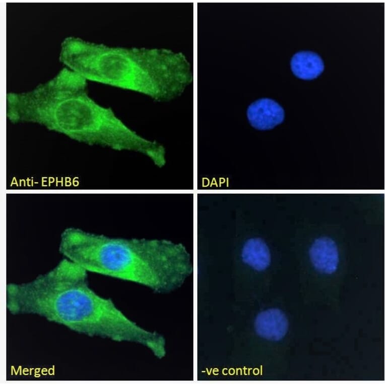 Immunofluorescence - Anti-Eph Receptor B6 Antibody (A121146) - Antibodies.com