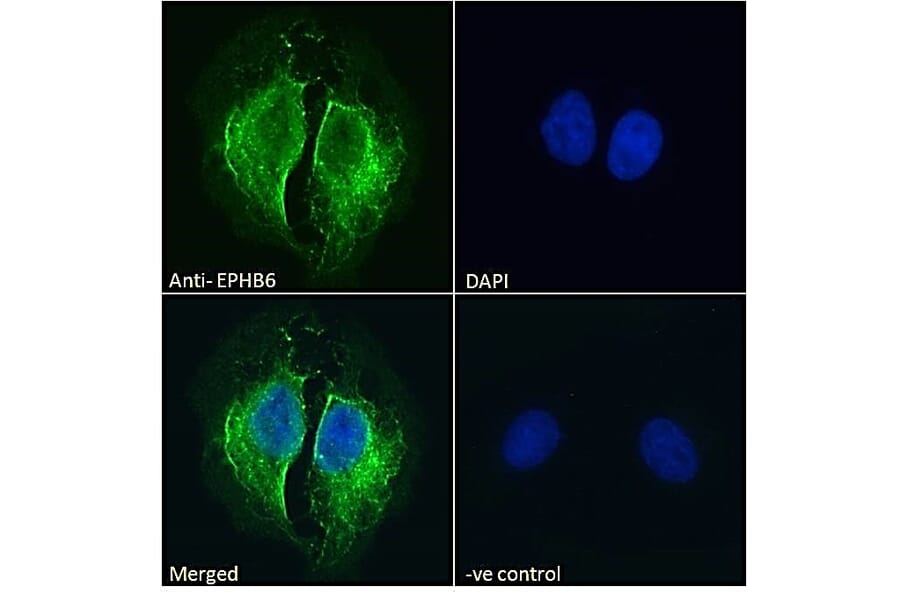 Immunofluorescence - Anti-Eph Receptor B6 Antibody (A121146) - Antibodies.com