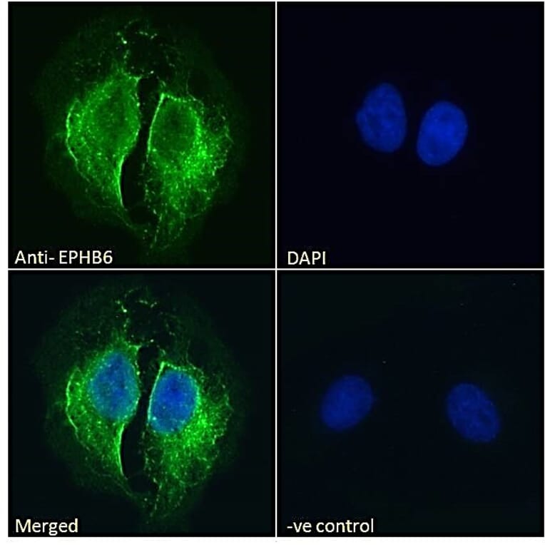 Immunofluorescence - Anti-Eph Receptor B6 Antibody (A121146) - Antibodies.com