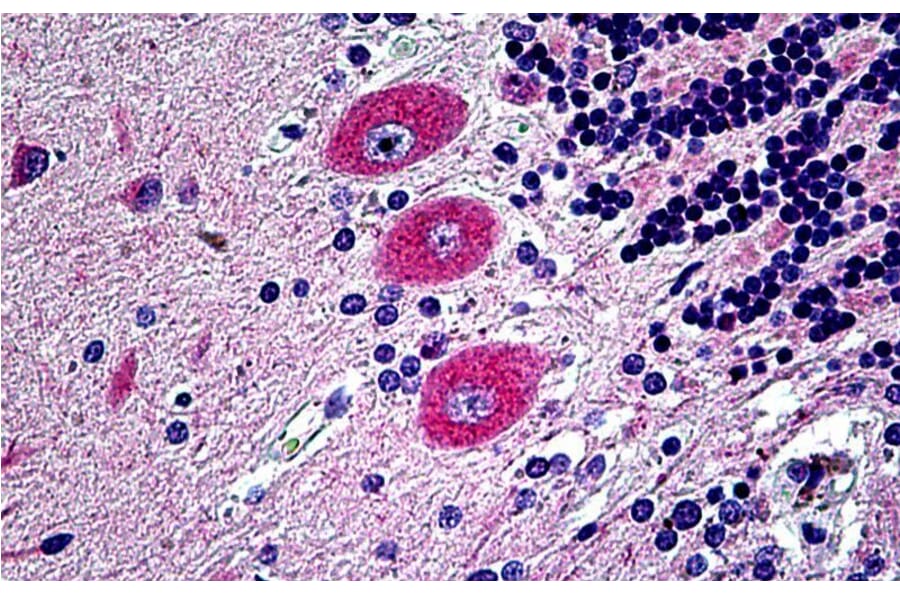 Immunohistochemistry - Anti-Eph Receptor B6 Antibody (A121146) - Antibodies.com